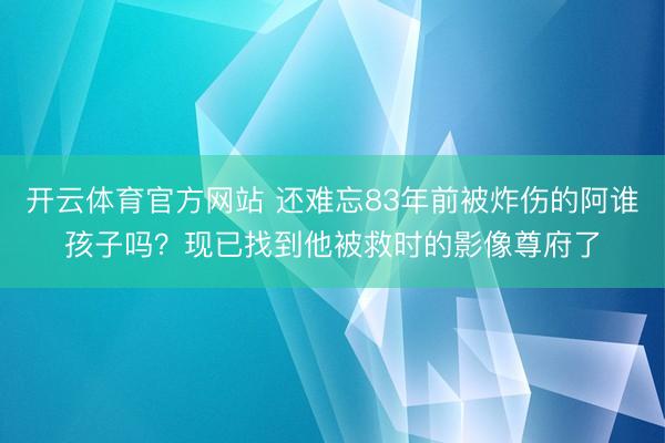 开云体育官方网站 还难忘83年前被炸伤的阿谁孩子吗？现已找到他被救时的影像尊府了