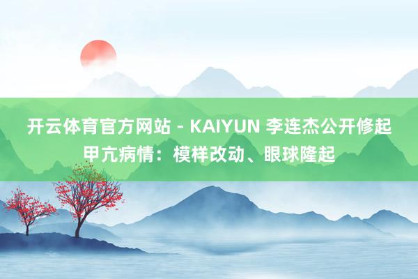 开云体育官方网站 - KAIYUN 李连杰公开修起甲亢病情：模样改动、眼球隆起
